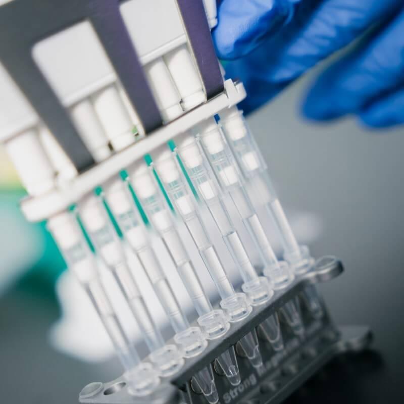 Pipettes on a laboratory bench