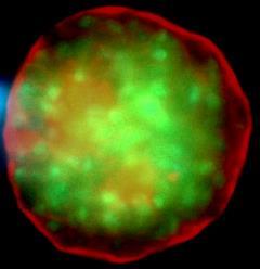 T. gondii tissue cyst, with cyst wall in red and parasites in green