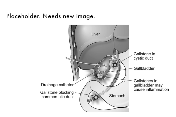 Hepatobiliary Interventions