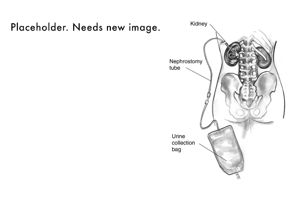 Renal Interventions