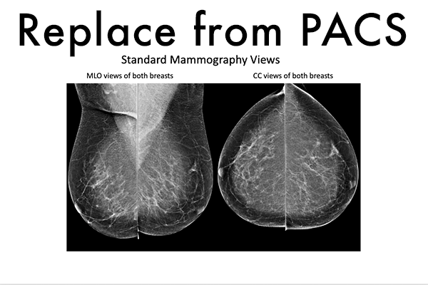 Mammography Standard Views Placeholder