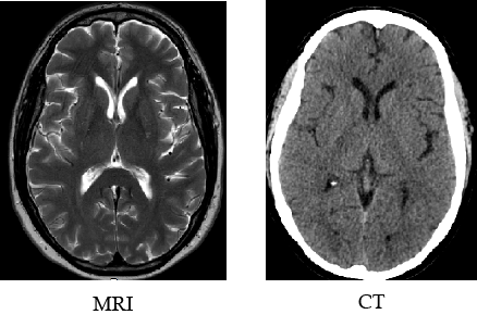 MRI of soft tissue