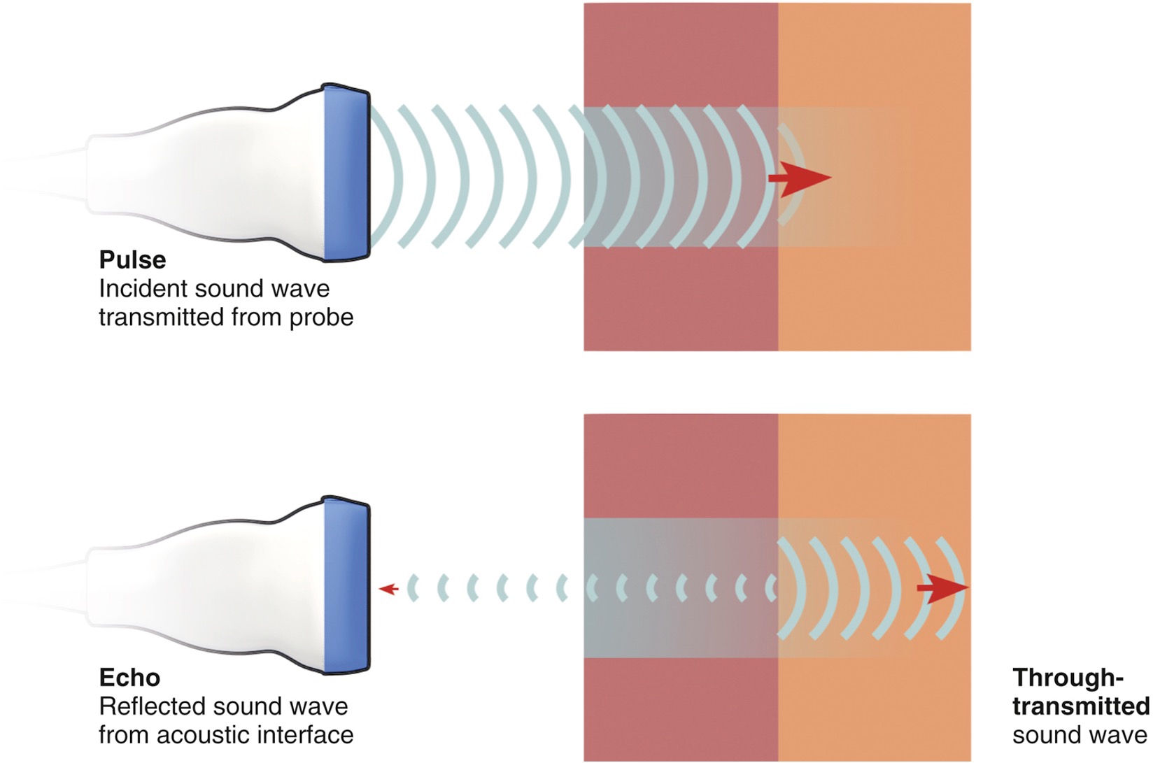 Basic ultrasound physics